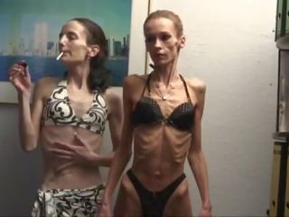 Anorexic 女孩 pose 在 swimsuits 和 伸展 为 该 相机